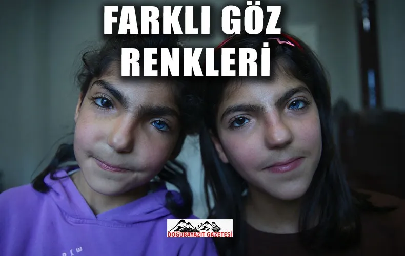 FARKLI GÖZ RENKLERİ OLAN KIZ KARDEŞLER GÖRENLERİ ŞAŞIRTIYOR