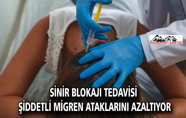 Sinir blokajı tedavisi şiddetli migren ataklarını azaltıyor