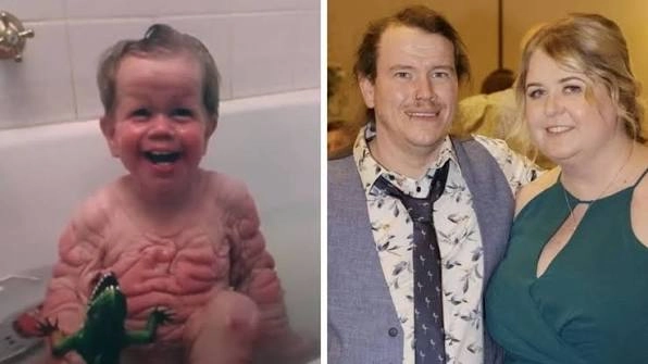 Benjamin Button Gerçek mi?