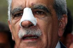Ahmet Türk Taburcu Oldu